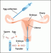 ivf-image[1]