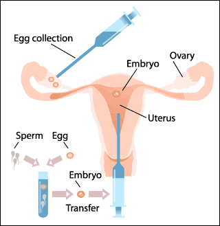ivf-image[1]