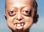 child