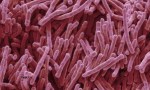 anti biotic