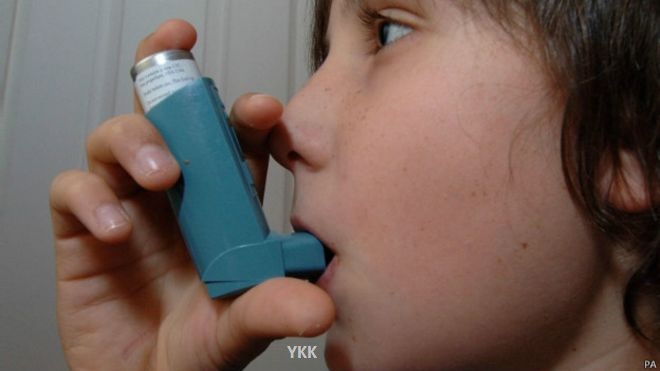 asthma